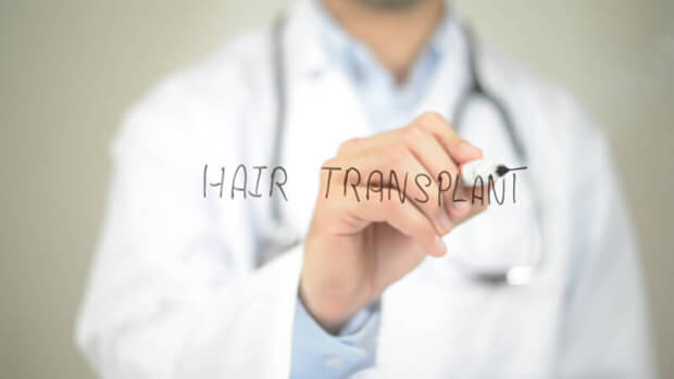 Haartransplantation | © panthermedia.net /ramerocrist.gmail.com